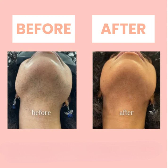 BareSmooth | Hair removal cream for women