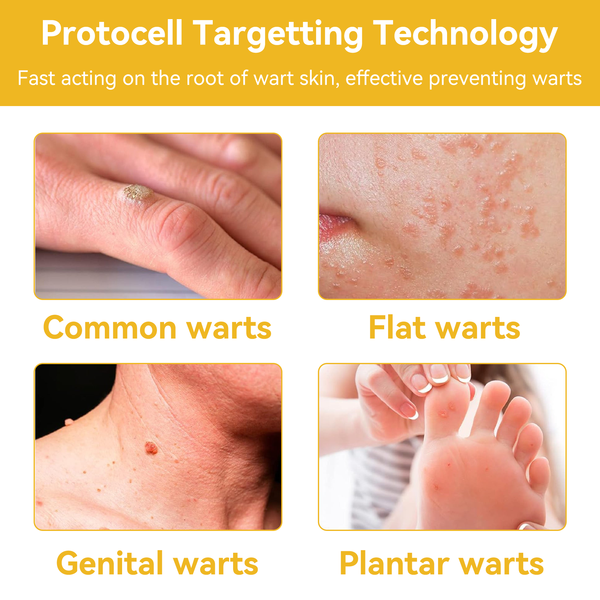 TagAway | Effective removal of warts and skin growths