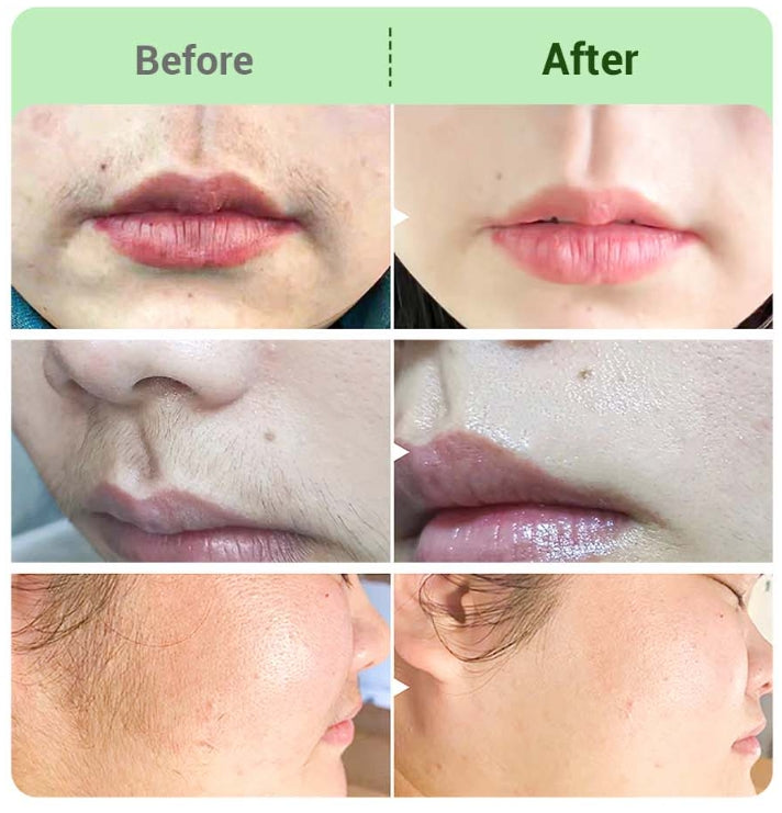 Silkora™ | Depilatory cream set for women