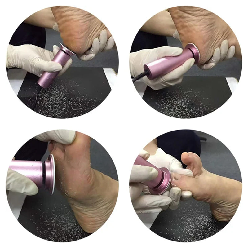 SoftFoot | Confident and Comfortable with Silky Soft Feet