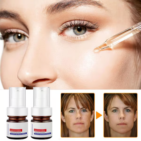 SpotLuxe | serum to remove dark spots