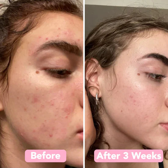 Kojimeric | Brightening Turmeric & Kojic Acid Pads | 40 Pads