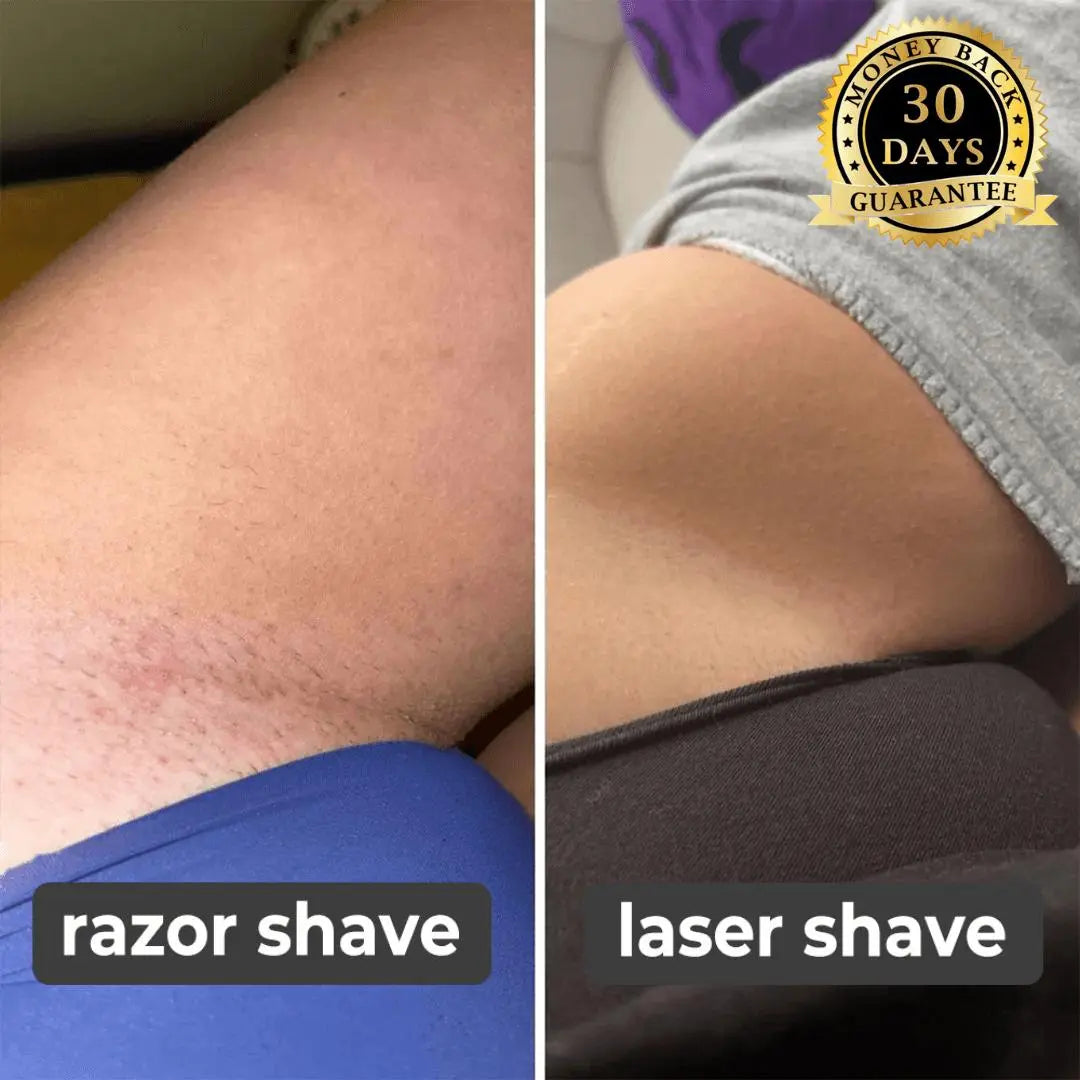 SilkErase - Effortless Hair Removal for Smooth Skin