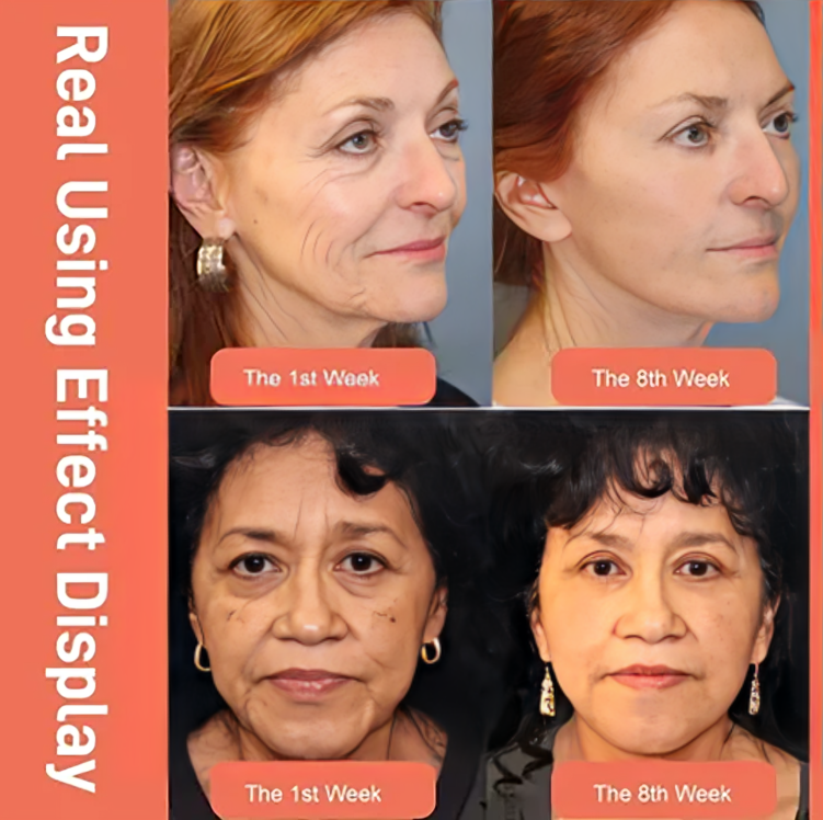 FirmGlow | Restores the vitality of the skin