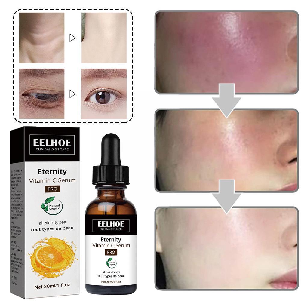 Eelhoe | Dark Spot Corrector Facial Serum