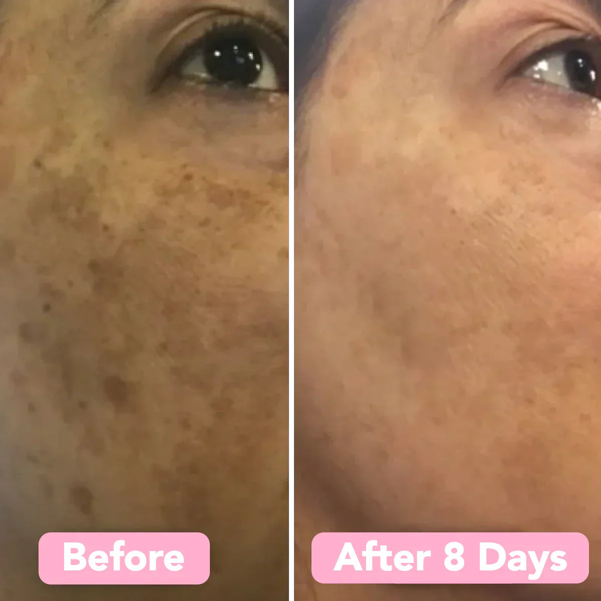 Kojimeric | Brightening Turmeric & Kojic Acid Pads | 40 Pads