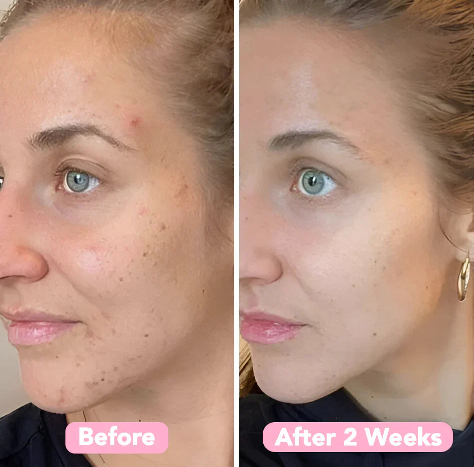 Kojimeric | Brightening Turmeric & Kojic Acid Pads | 40 Pads