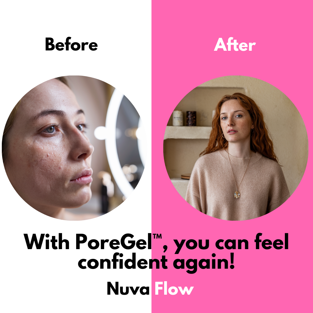 1+1 FREE | PoreGel™ - Be confident in your own skin again!