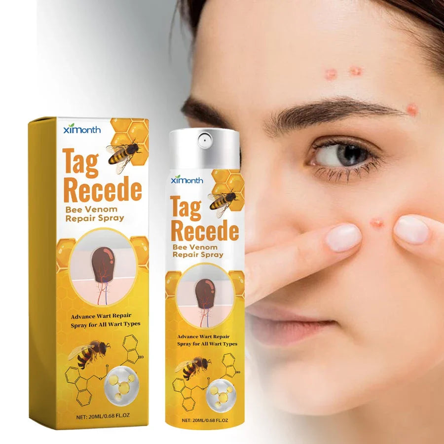 TagAway | Effective removal of warts and skin growths