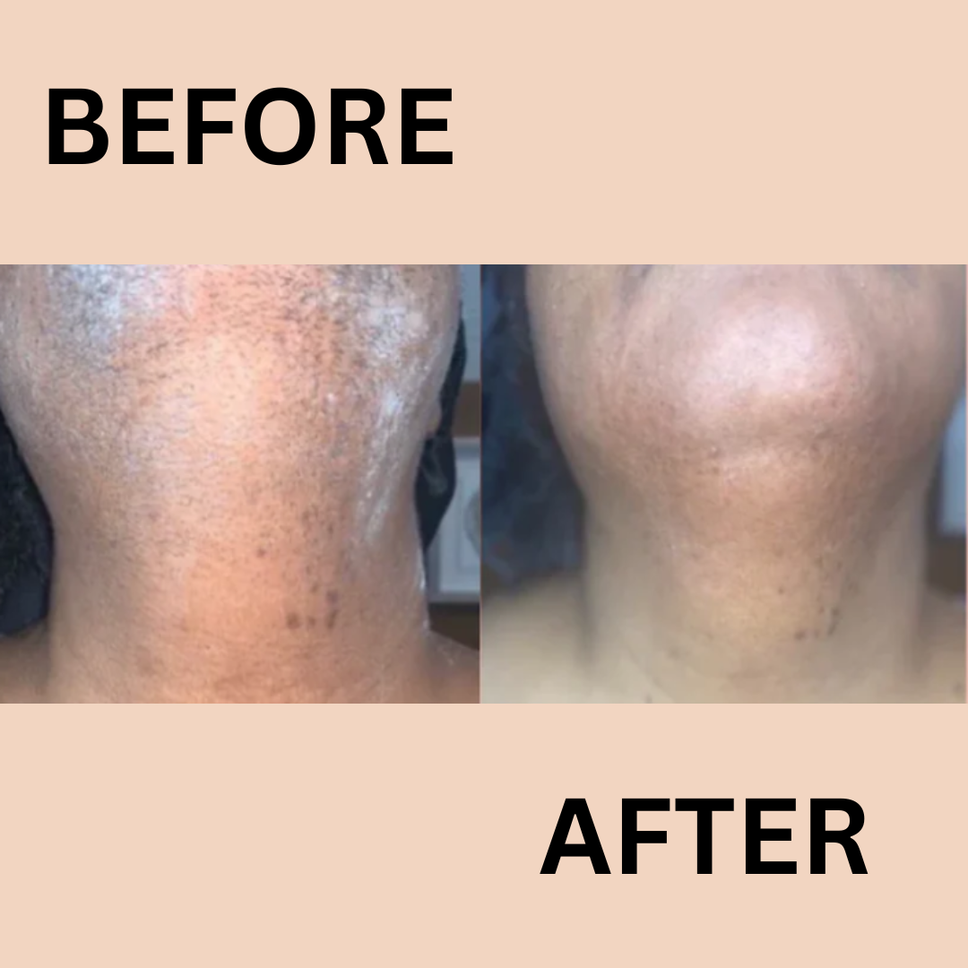 BareSmooth | Hair removal cream for women