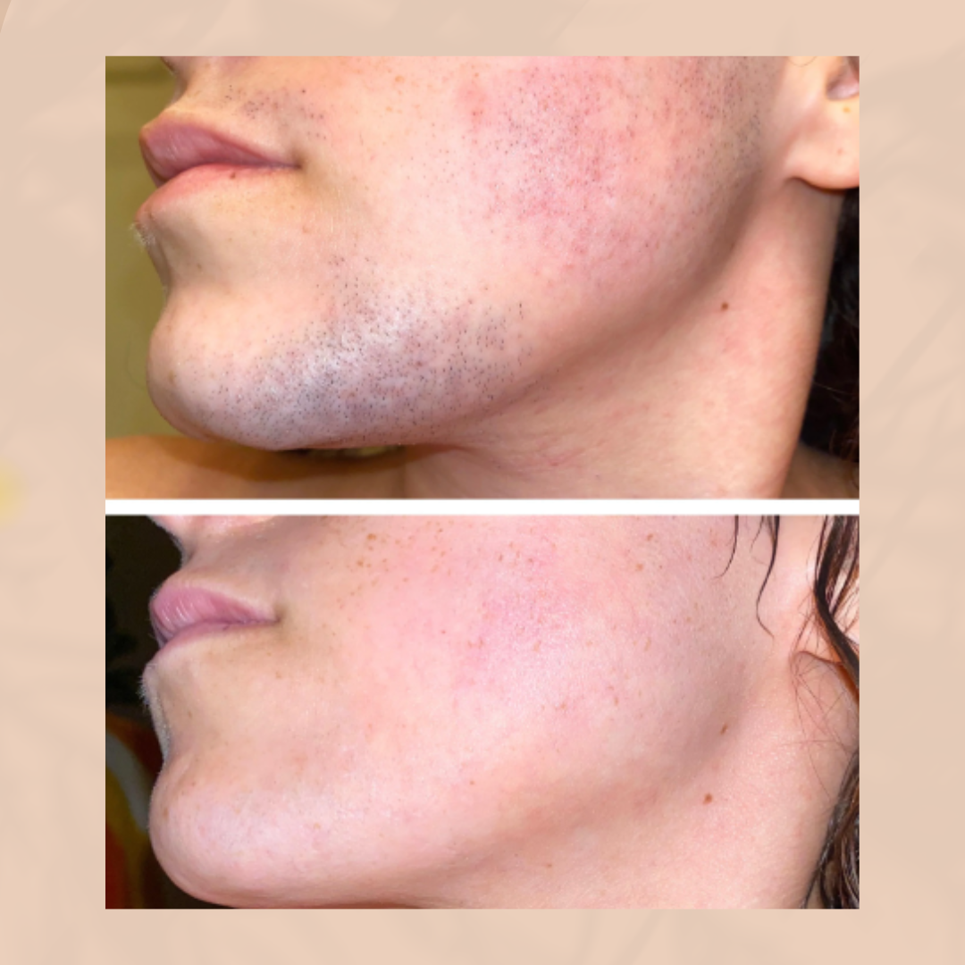 BareSmooth | Hair removal cream for women