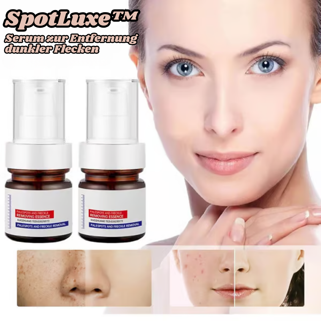 SpotLuxe | serum to remove dark spots