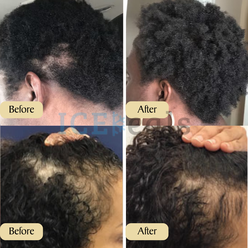 GrowthGlow | Plant-based formula with 10+ oils for intense hydration and protection