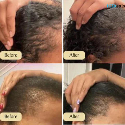 GrowthGlow | Plant-based formula with 10+ oils for intense hydration and protection