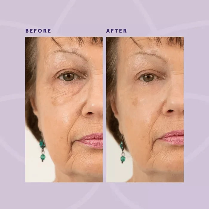 MiracleEye - Wrinkle Eraser Firming Eye Cream