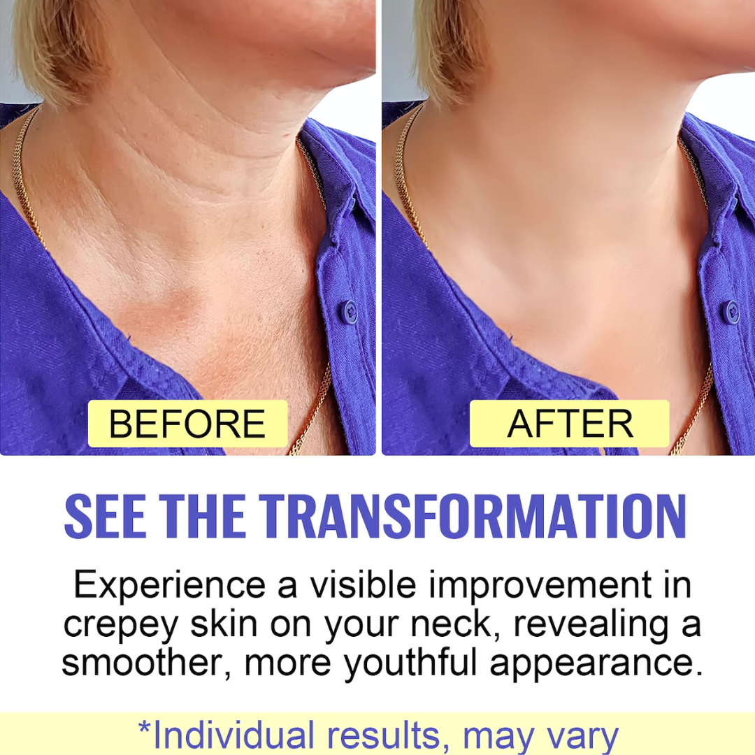 UltraFirm | Experience the magic of Advanced Neck Lifting and Firming Cream